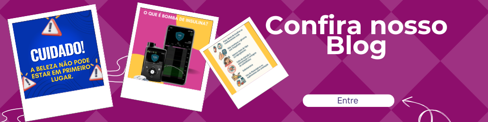 Confira nosso blog